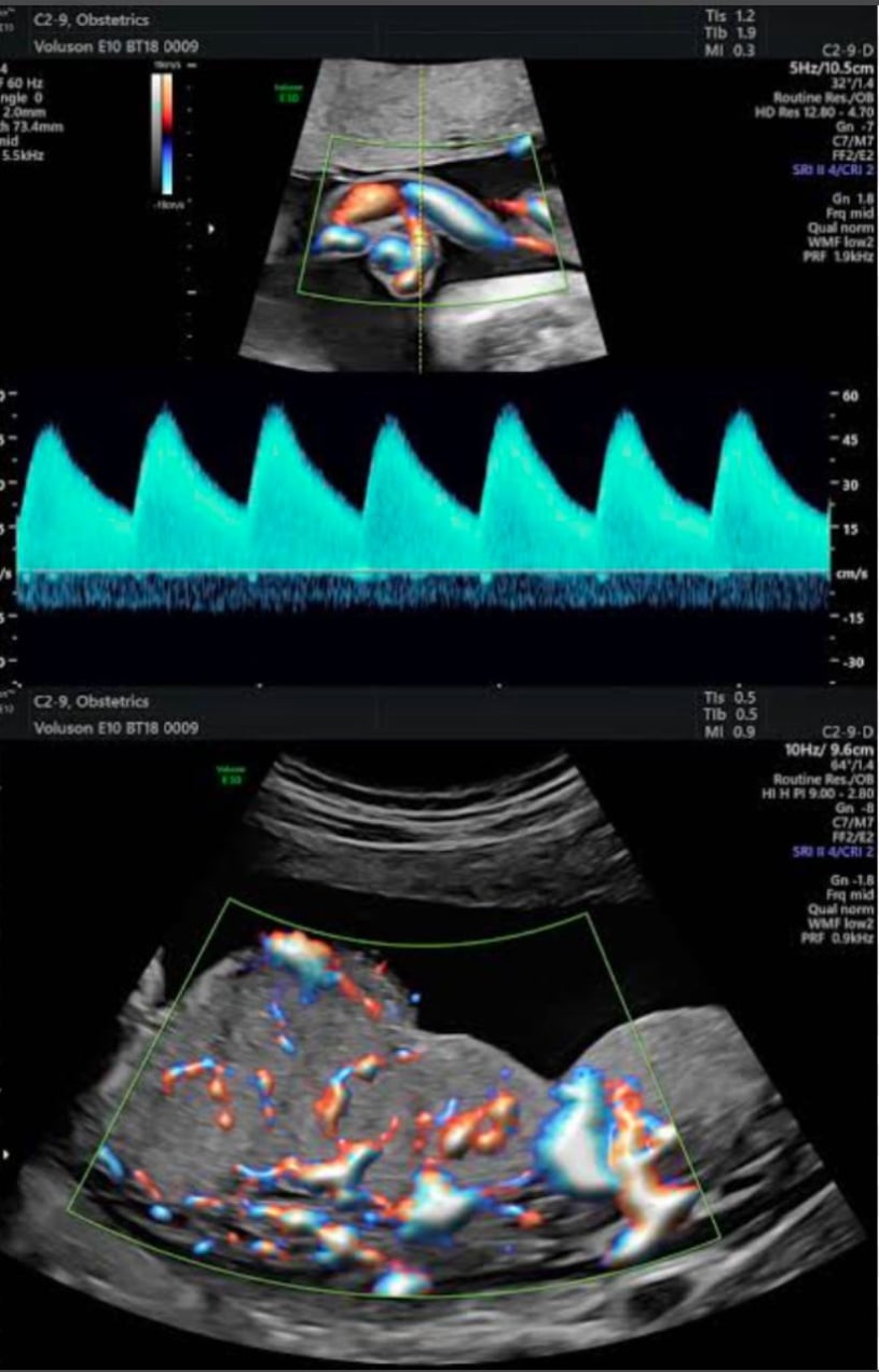 Foto - Ultrassonografia Doppler Colorido e 4D